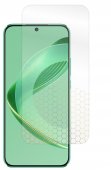 Folie pentru Huawei Nova 11 SE, King Protection